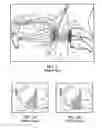Fig. 02 - Method of stimulating a hypoglossal nerve for controlling the position of a patient's tongue