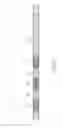 Fig. 07 - Electronic stimulation device, method of treatment and electronic stimulation system
