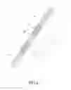 Fig. 14 - Electronic stimulation device, method of treatment and electronic stimulation system