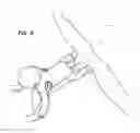 Fig. 06 - Apparatus and method for exercising with a child attached to the legs