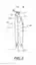 Fig. 04 - Exercise balance and flexibility method