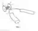 Fig. 02 - Stem removing tool