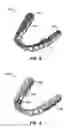 Fig. 06 - SYSTEMS AND METHODS FOR VARYING ELASTIC MODULUS APPLIANCES