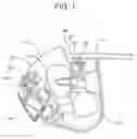 Fig. 02 - Windshield wrapped vehicle pillar