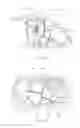 Fig. 03 - Front-head/chest airbag