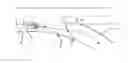 Fig. 01 - Method and device for regulating the speed of a vehicle