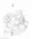 Fig. 08 - Gear drive two-wheel scooter