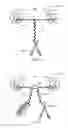 Fig. 05 - System and apparatus for positioning a floatation device