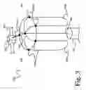 Fig. 04 - Enhanced system and method for detangling and protection of automatic fender positioning systems