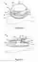 Fig. 07 - Child-resistant senior-friendly medication bottle closure