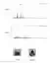 Fig. 04 - BIOSOURCED COMPOUND HAVING EPOXIDE FUNCTIONS, METHOD FOR THE SYNTHESIS OF SUCH A COMPOUND, AND USE THEREOF FOR PRODUCING EPOXY RESIN