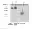 Fig. 07 - RECOMBINANT pMHC CLASS II MOLECULES