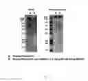 Fig. 14 - Process for a preparation of the modified porcine plasma fibronectin for enhance wound healing