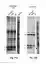 Fig. 23 - Antibodies for the treatment of synucleinopathy