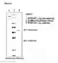 Fig. 10 - Anti-ROR2 antibodies