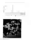 Fig. 11 - CERIUM OXIDE-COATED ZINC OXIDE PARTICLE, METHOD FOR PRODUCING THE SAME, ULTRAVIOLET SHIELDING AGENT, AND COSMETIC