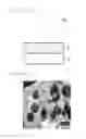 Fig. 02 - Adhesive tape and method of manufacturing thereof