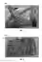 Fig. 02 - Date tree spikelet-based additive for mechanical reinforcement of weak and unstable lost circulation material (LCM) seals/plugs