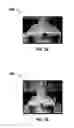 Fig. 04 - Date tree spikelet-based additive for mechanical reinforcement of weak and unstable lost circulation material (LCM) seals/plugs