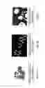 Fig. 02 - System and Method to Decrease the Viscosity of the Crude Oil and the Potentiation of Dehydration