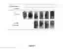 Fig. 06 - COMPOSITION FOR TREATING TENDONITIS AND MANUFACTURE THEREOF