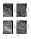 Fig. 07 - Biologic sample collection devices and methods of production and use thereof