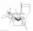Fig. 01 - Flexible, constant-downward-pressure obstructed piping clearing system