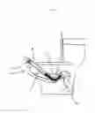 Fig. 12 - Flexible, constant-downward-pressure obstructed piping clearing system