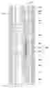 Fig. 01 - DEGRADABLE DOWNHOLE TOOLS COMPRISING CELLULOSIC DERIVATIVES