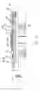 Fig. 03 - POWDER METAL GRIPPING ELEMENTS FOR SETTABLE DOWNHOLE TOOLS HAVING SLIPS