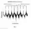 Fig. 07 - Sensing formation properties during wellbore construction