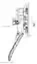 Fig. 02 - Drum housing for a working drum of a construction machine or mining machine, construction machine or mining machine, as well as method for monitoring the condition of a working drum of a construction machine or mining machine