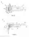 Fig. 08 - Wastegate for an engine system