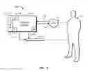 Fig. 02 - Heat exchanges system for patient temperature control with easy loading high performance peristaltic pump
