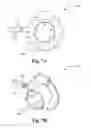 Fig. 09 - Braking device, system and method