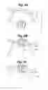Fig. 06 - Tangle-resistant decorative lighting assembly