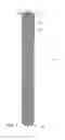 Fig. 02 - Metallic wick