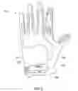 Fig. 03 - Glove for incapacitating an individual