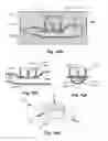 Fig. 09 - Pressure measurement devices, methods, and systems