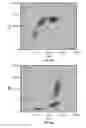Fig. 08 - Nucleated red blood cell analysis system and method