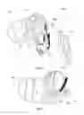 Fig. 07 - MAGNIFYING AND LIGHTING APPARATUS FOR VIEWING TOENAILS