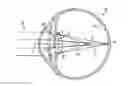 Fig. 01 - Lens having an optical add power progression
