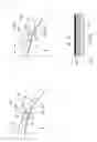 Fig. 04 - CONTACT AND INTRAOCULAR LENSES COMPRISING AN ADJUSTABLE FOCUS LENGTH