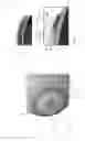 Fig. 05 - CONTACT AND INTRAOCULAR LENSES COMPRISING AN ADJUSTABLE FOCUS LENGTH