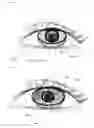 Fig. 09 - CONTACT AND INTRAOCULAR LENSES COMPRISING AN ADJUSTABLE FOCUS LENGTH
