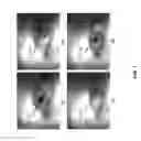 Fig. 02 - Method and system for eye tracking using speckle patterns