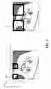 Fig. 07 - ENHANCED SIAMESE TRACKERS