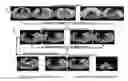 Fig. 01 - Self-aware image segmentation methods and systems