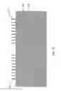 Fig. 07 - SPACER DEFINED FIN GROWTH AND DIFFERENTIAL FIN WIDTH