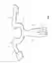 Fig. 02 - PROTECTION DEVICE AND METHOD FOR MANUFACTURING SUCH A PROTECTION DEVICE